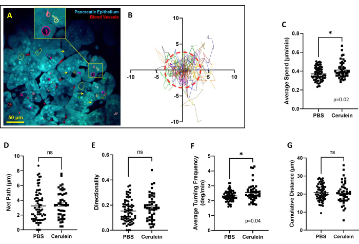 figure-results-5 Pancreatic epithelium diagram; microscopy image and cell motility data; charts compare PBS vs cerulein.