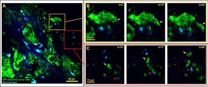 figure-results-6 Fluorescence microscopy, KPC-Dendra2 tumor cells, macrophages interaction, experimental analysis.
