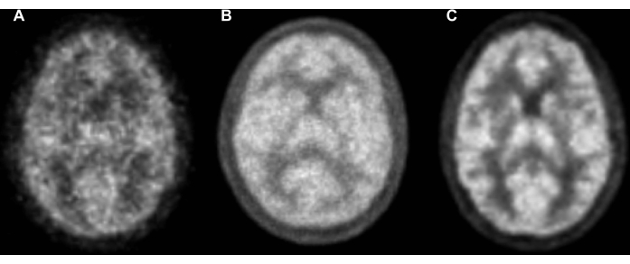 Brain MRI scans, comparison diagram for diagnostic imaging and analysis in medical research.