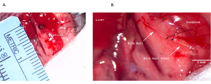 figure-results-4 Bile duct stent procedure diagram; surgical setup for liver to duodenum connection in experimental study.