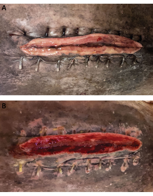 figure-results-3 Surgical wound healing comparison, skin staples, clinical result, tissue repair process.