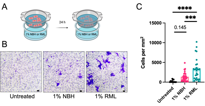 Cell culture experiment; NBI/RML treatment; microscopy image; cell density graph analysis.