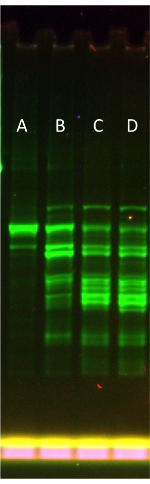figure-results-2 Electrophoresis result, DNA separation, gel bands, fluorescence imaging, genetic analysis technique.