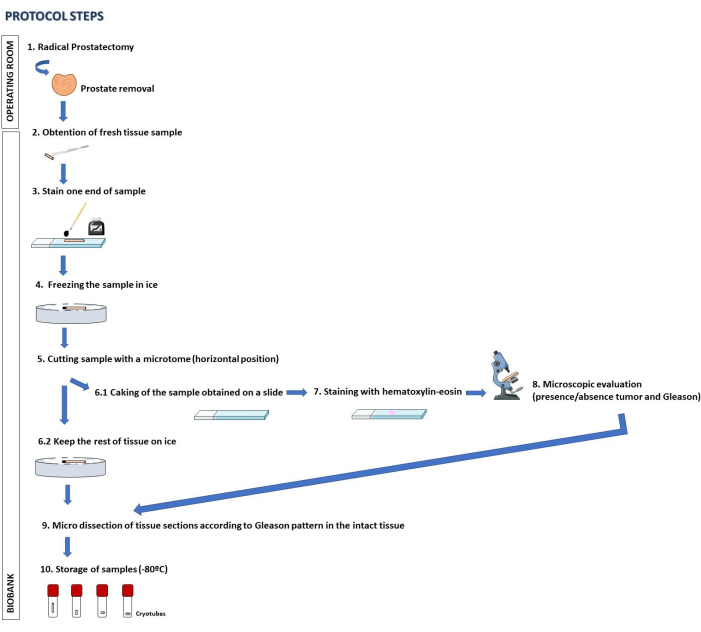 Prostatectomy protocol: tissue staining, microtome cutting, Gleason pattern analysis; diagram.
