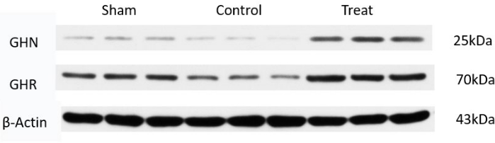 figure-results-7 Western blot analysis; GHN, GHR protein expression; Sham, Control, Treat groups; 25kDa, 70kDa bands.