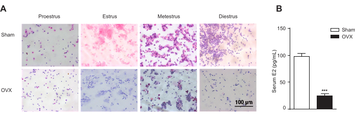 figure-results-3 Histology photomicrographs, ovarian cycle stages; graph shows serum E2 levels in Sham vs. OVX.