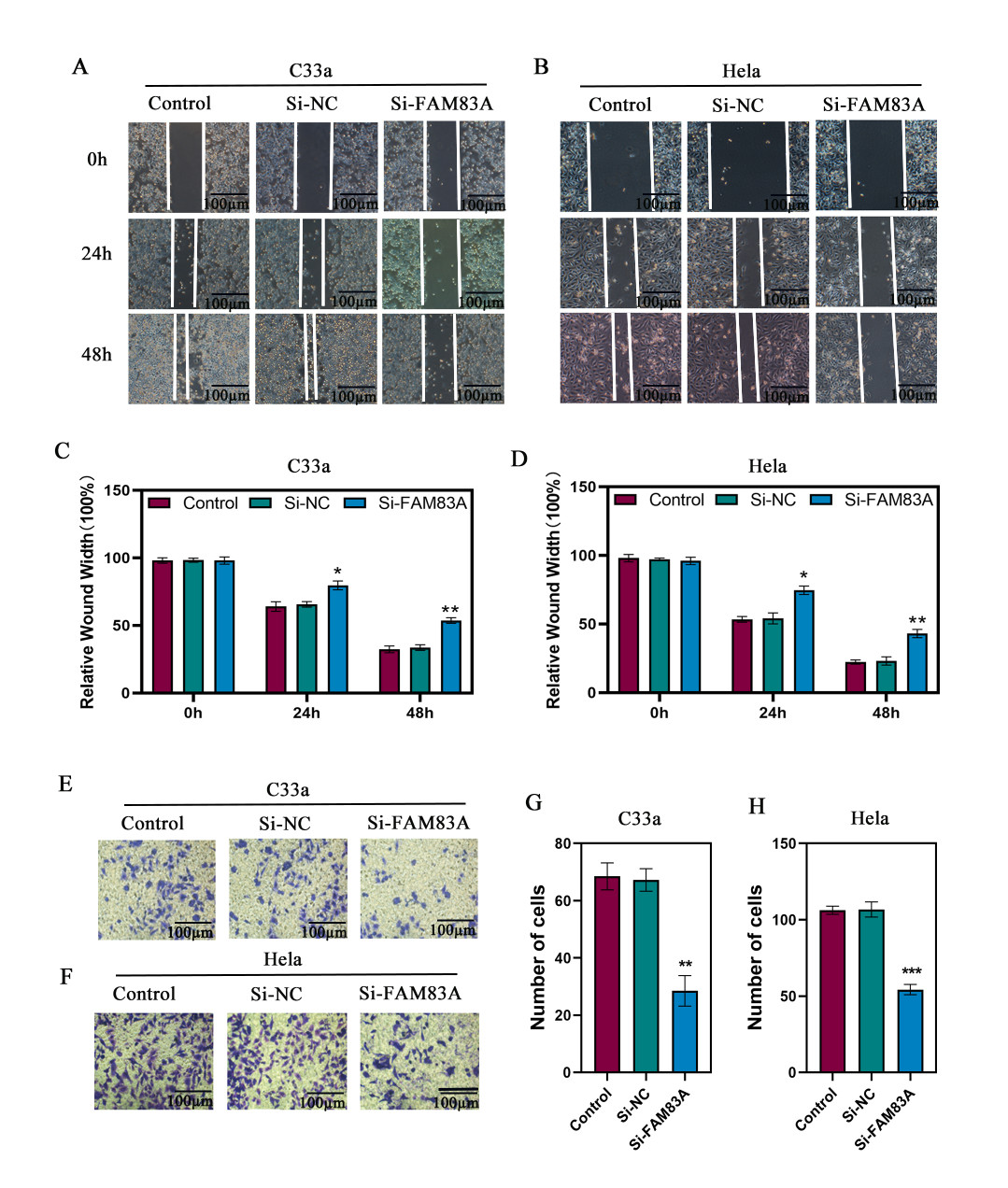 Knockdown of FAM83A to Verify Its Role in Cervical Cancer Cell Growth ...