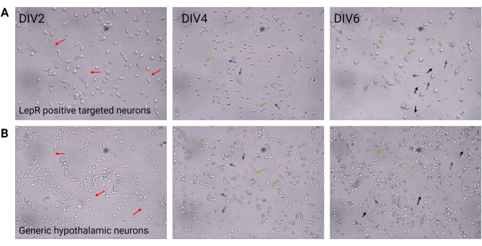 Lepr positive and generic hypothalamic neurons microscopy at DIV2, DIV4, DIV6 in culture study.