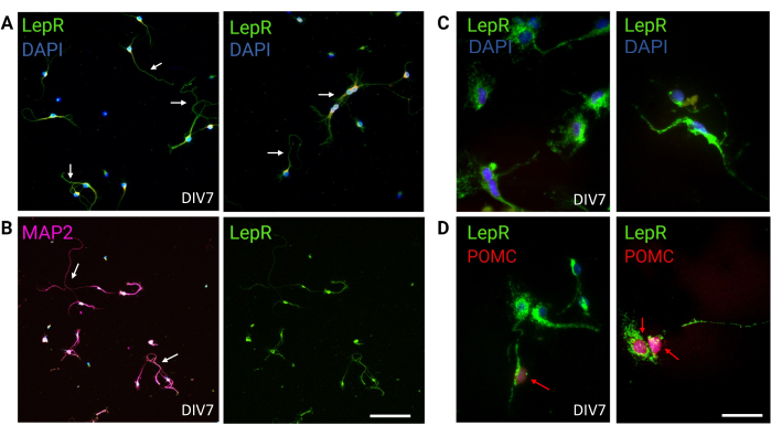 Immunofluorescence microscopy of LepR and DAPI, MAP2, POMC markers in neural cells at DIV7.