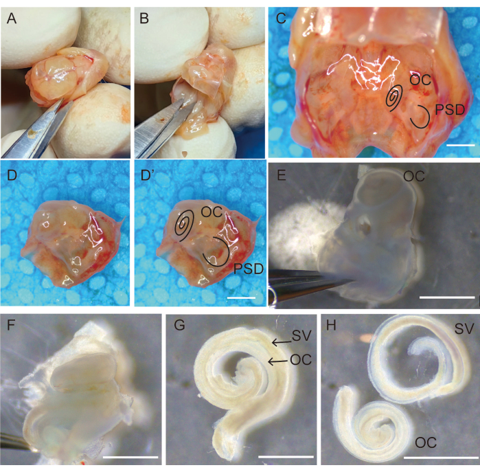 Ear dissection stages, cochlear anatomy, labeled diagram, OC and PSD identification, research study.