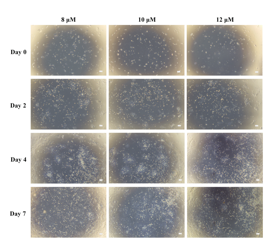 Generating Kidney Organoids in Suspension from Induced Pluripotent Stem ...