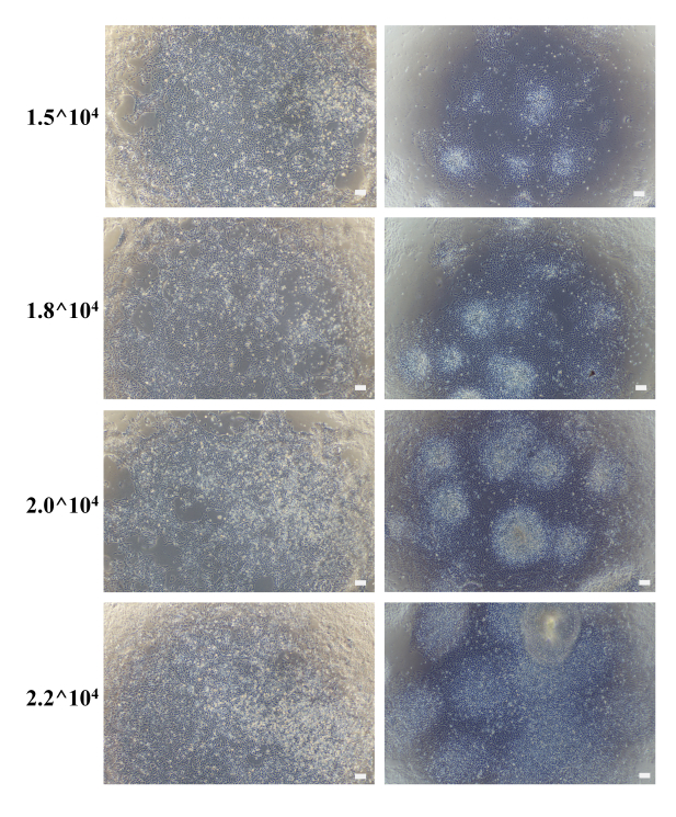 Generating Kidney Organoids in Suspension from Induced Pluripotent Stem ...