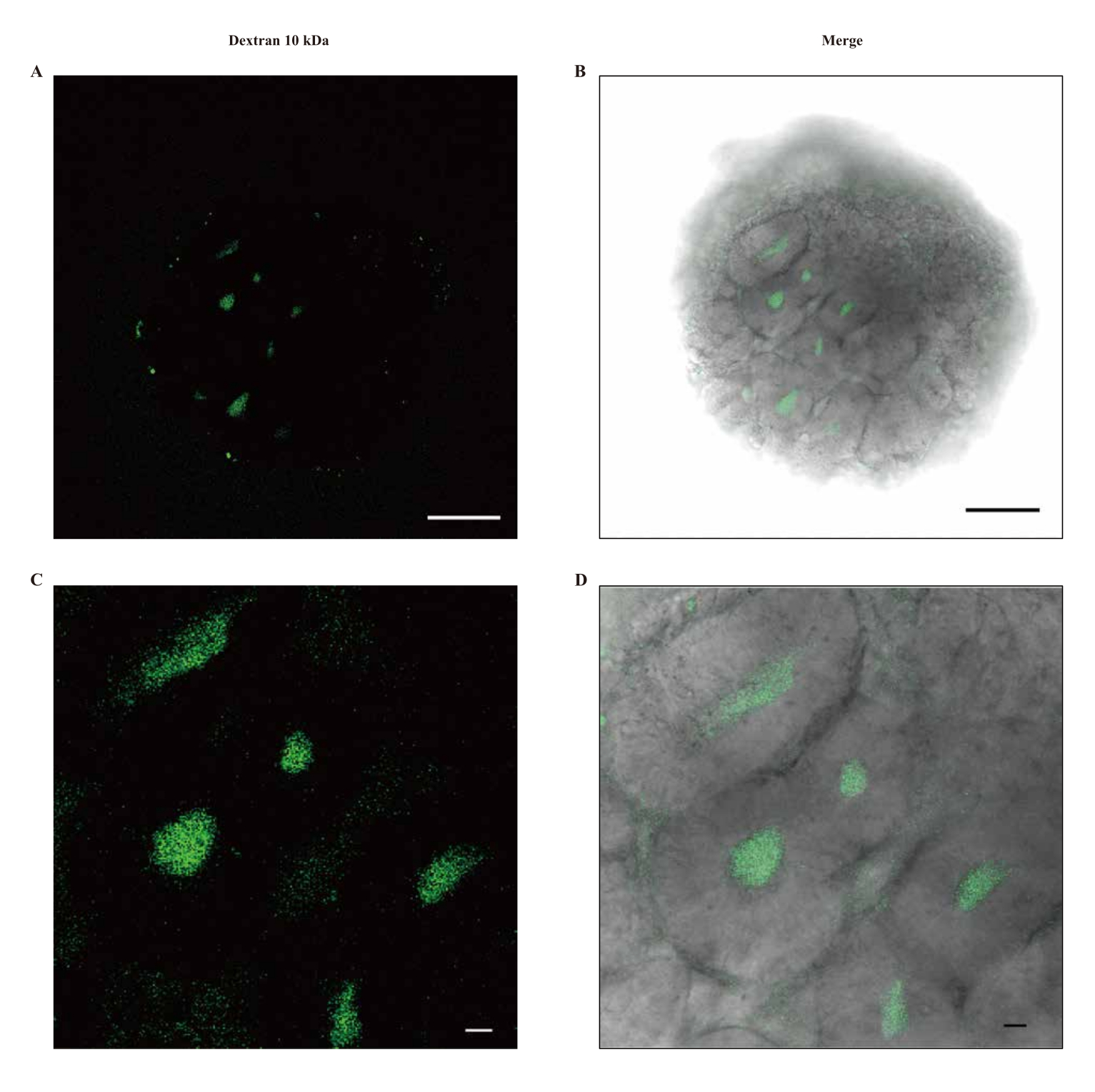 Generating Kidney Organoids in Suspension from Induced Pluripotent Stem ...