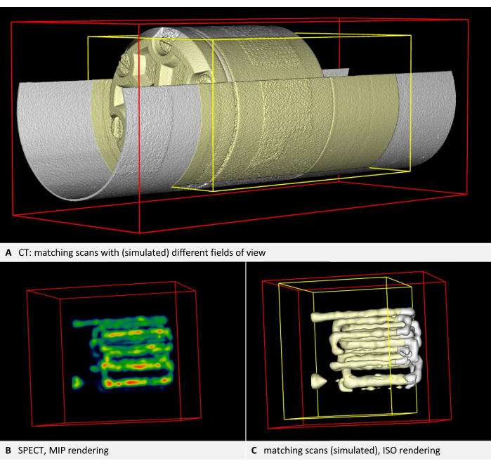 CT scan comparison, varied fields of view: diagram with SPECT, MIP, ISO renderings for analysis.