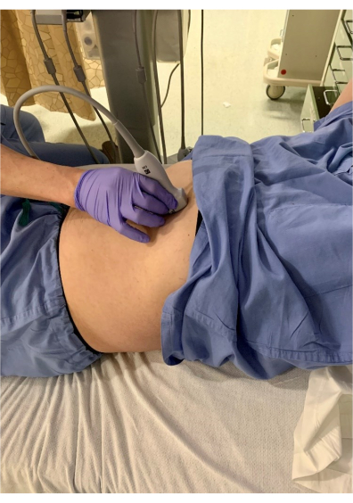 figure-results-1 Ultrasound procedure, abdominal scan, healthcare diagnostics, medical imaging, ultrasound device.