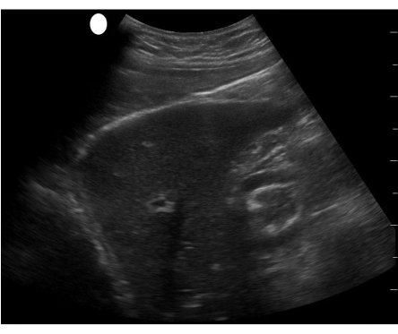 figure-results-9 Ultrasound scan; medical imaging; abdominal organ structure for diagnostic analysis.
