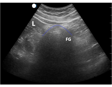 figure-results-11 Ultrasound imaging; liver and focal gallbladder; diagnostic ultrasound scan; medical imaging analysis.
