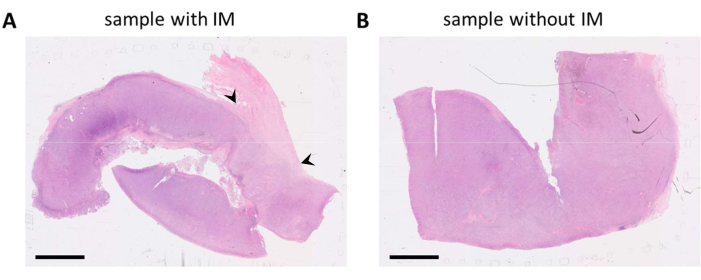 figure-results-1 Histology comparison of tissue samples; labeled "with IM" and "without IM"; microscopic analysis.