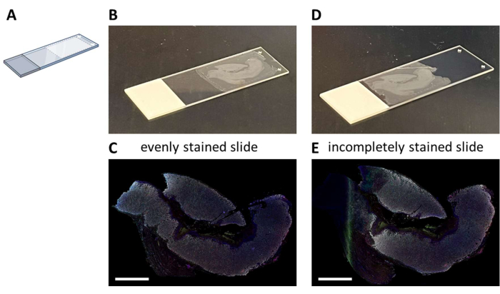 figure-results-2 Microscope slide staining comparison; diagrams and results show even vs. incomplete stain in histology.