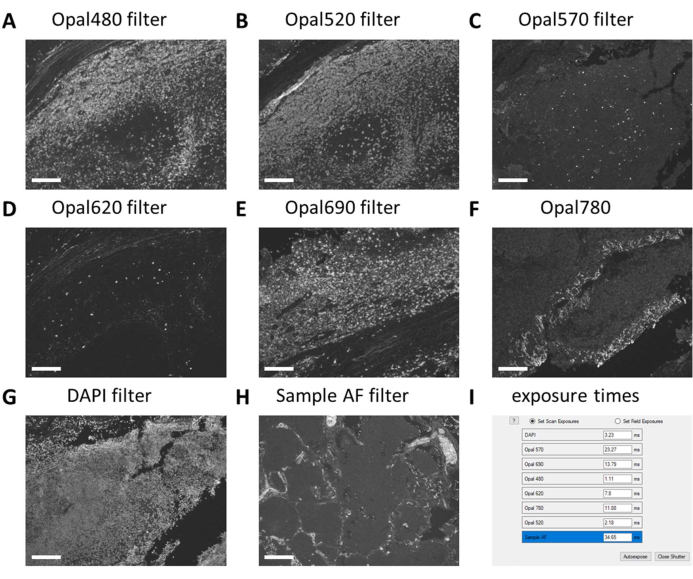 figure-results-3 Microscopy filter comparison for fluorescence imaging; shows Opal filters and exposure settings diagram.