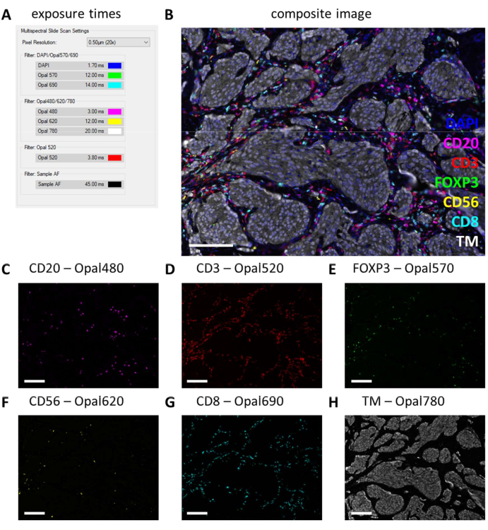 figure-results-4 Immunofluorescence analysis, CD markers, Opal dyes, composite image, multispectral imaging.