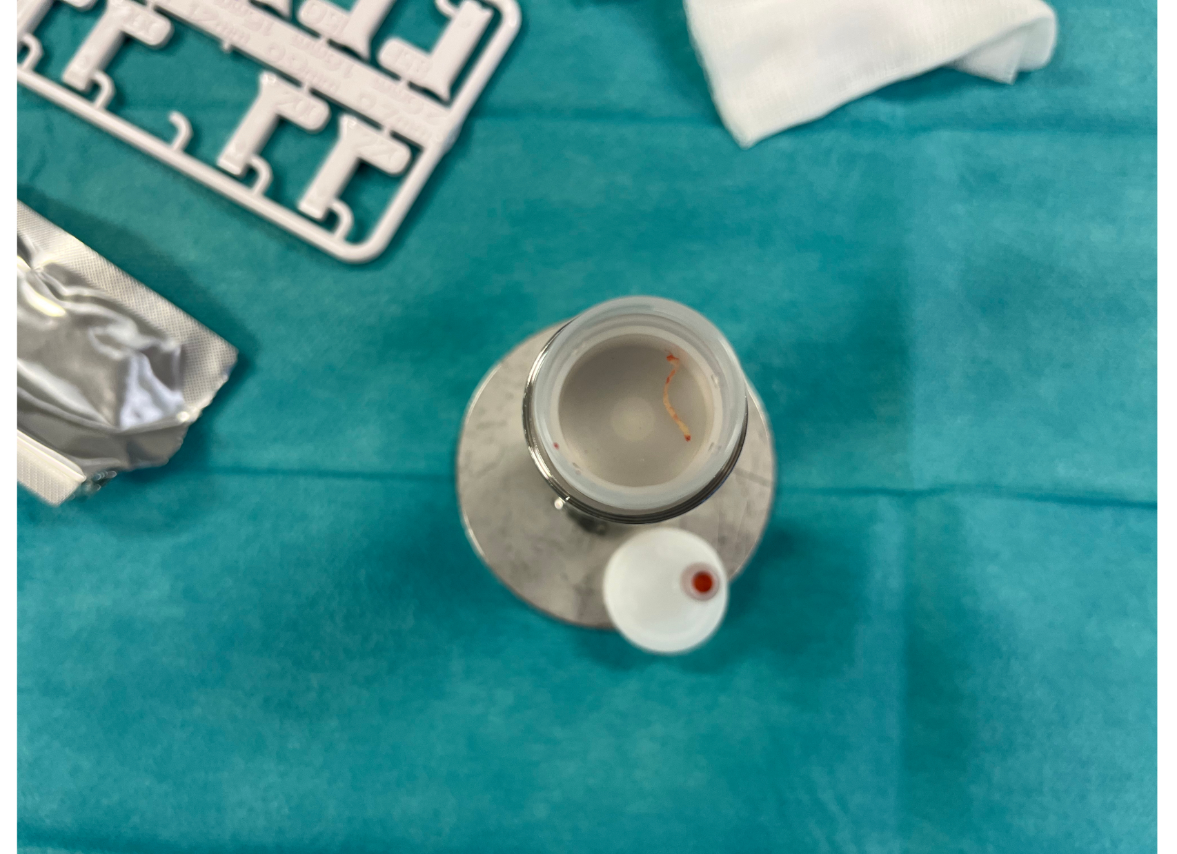 A Stepwise Approach for Performing Ultrasound Guided Transthoracic Lung ...