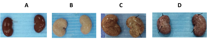 figure-results-5 Kidney comparison; A-D stages; pathology study; organ analysis; arrows indicate anomalies.