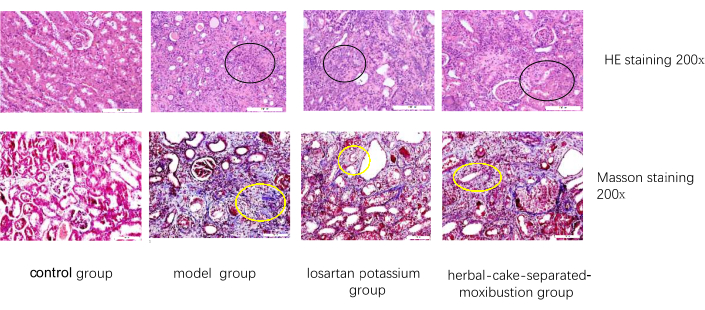 figure-results-9 Histological analysis, HE and Masson staining, kidney tissues, control vs treatment groups.