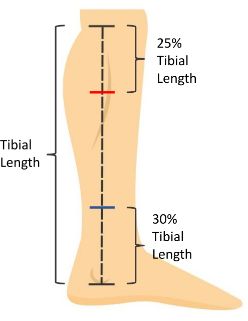 Tibial length diagram, 25% and 30% measurements, anatomical study, biomechanical analysis.