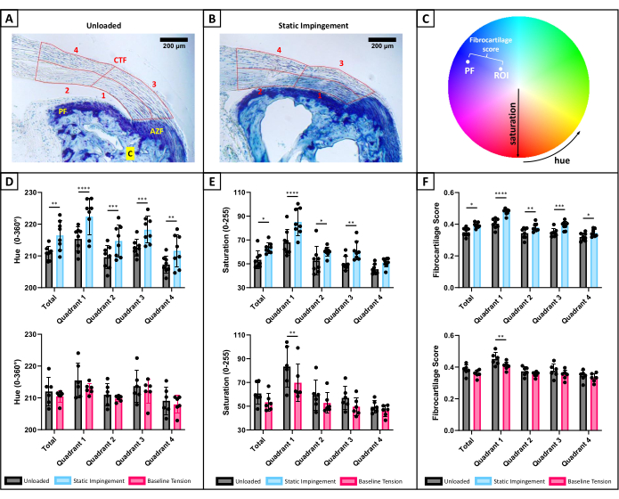 Static impingement microscopy and hue-saturation analysis in fibrocartilage with bar graphs and color wheel.