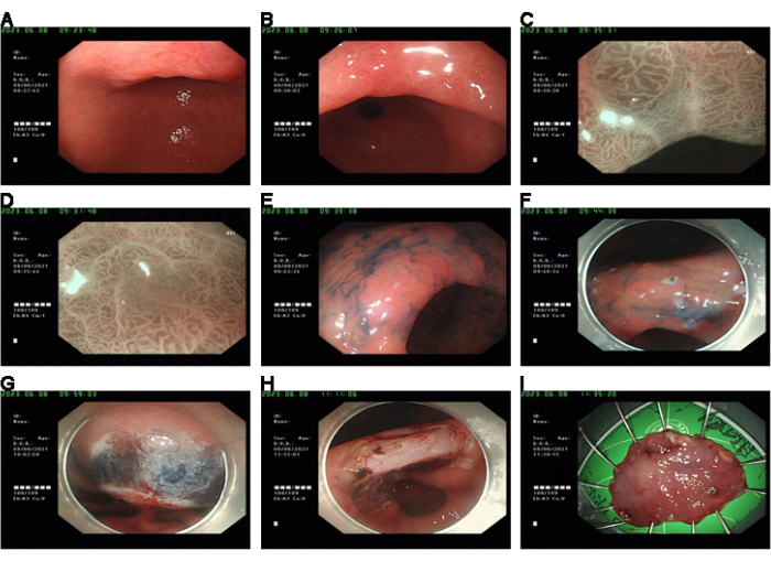 figure-results-1 Endoscopic examination images of gastrointestinal tract, showing various conditions and biopsies.
