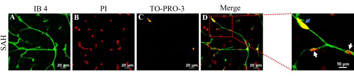 Imaging Vital and Non-vital Brain Pericytes in Brain Slices following ...