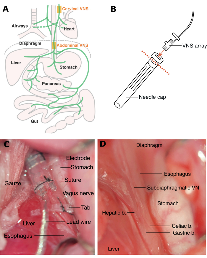 figure-results-1 Vagus nerve stimulation diagram and surgical setup for electrode placement on stomach and liver.