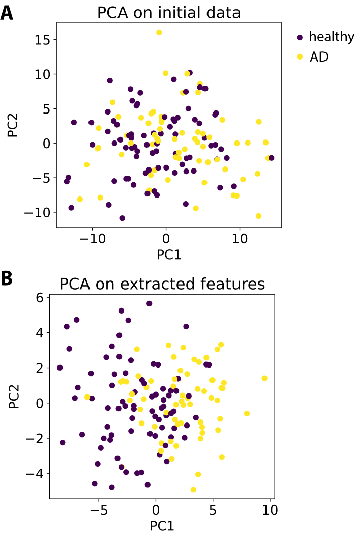 PCA scatter plots comparing initial data and extracted features for healthy/AD, diagram analysis.