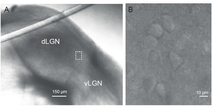 figure-results-2 Microscope image of mouse dLGN and vLGN, cellular detail. Scale bars: 150 µm, 10 µm.