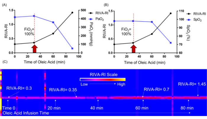 figure-results-3 Oleic acid infusion effects; graphs (PaO2, SpO2) and RIVA-RI scale; oxygenation response analysis.
