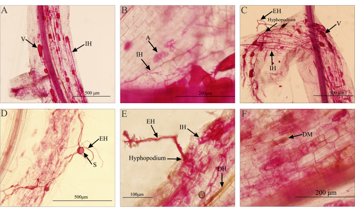 figure-results-1 Microscopy images of plant-fungal interactions; hyphae structures with hyphopodia visible.
