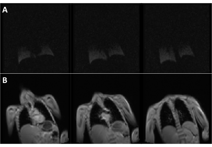MRI scan comparison; brain imaging; analysis of A and B datasets; diagnostic imaging results.