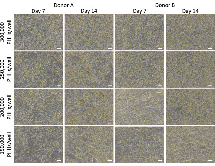 figure-results-3 Liver cell culture density comparison over time; microscopy images; cell growth analysis; Donor A vs. B.