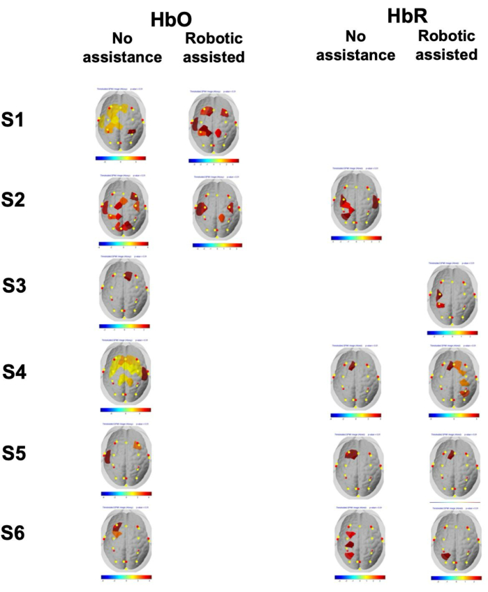 Brain activity heat map images comparing HbO and HbR with and without robotic assistance, 6 subjects.