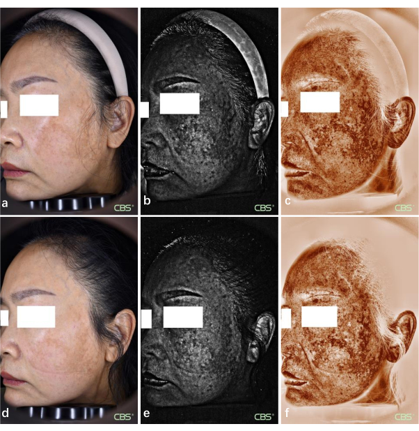 figure-results-4 Facial skin analysis using multispectral imaging; diagram showing pigmentation and texture features.