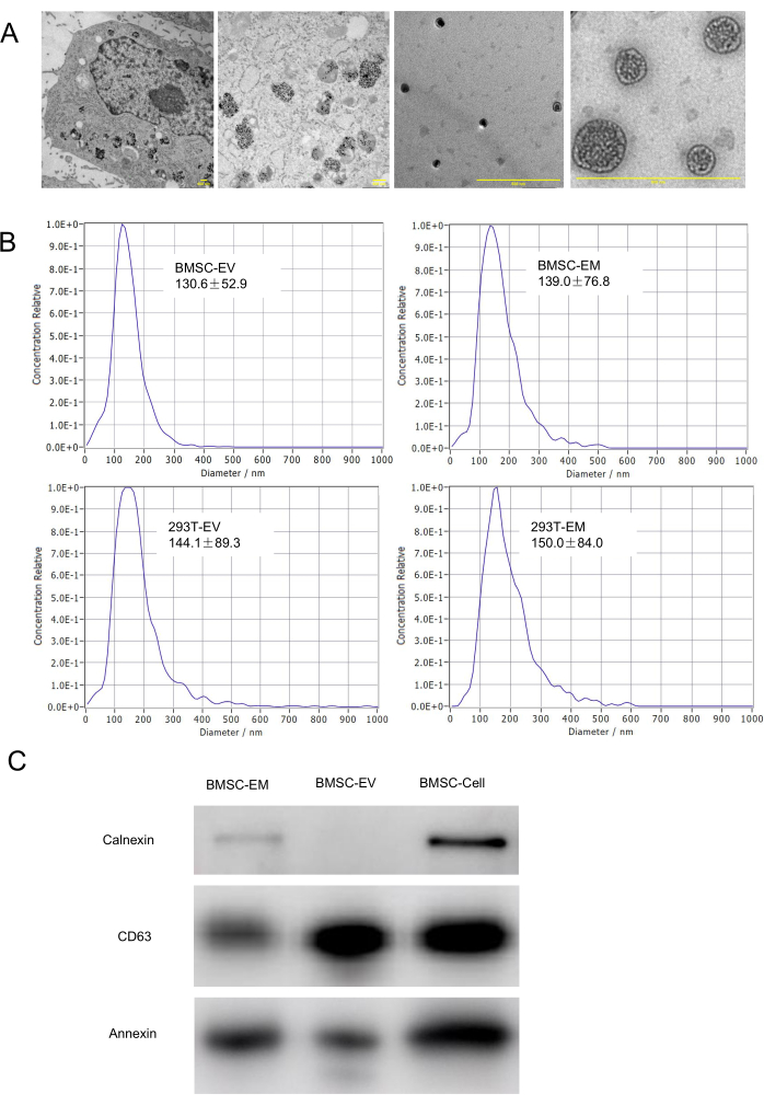 figure-results-3 Electron microscopy images of nanoparticles; size distribution graphs; protein analysis by Western blot.