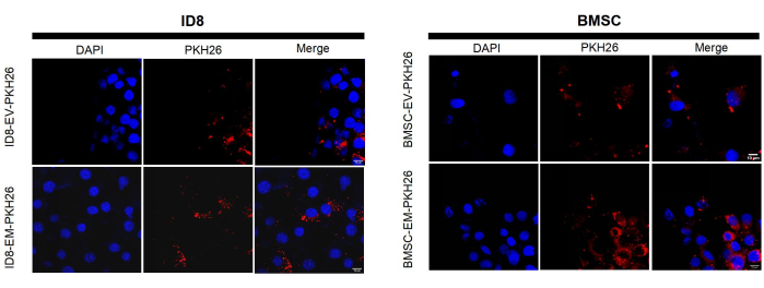 figure-results-5 Fluorescence microscopy of ID8/BMSC cells; DAPI nuclear stain and PKH26 dye, merge analysis.