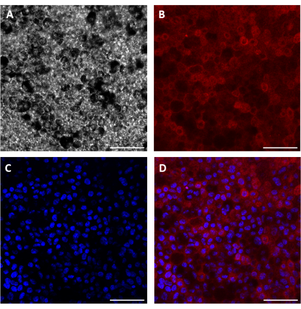Fluorescence microscopy images; cell staining; red, blue fluorescence; cellular analysis.