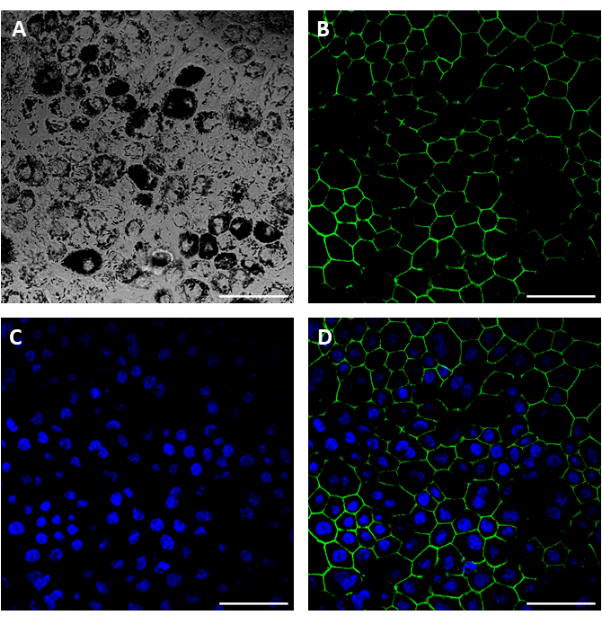 Fluorescence microscopy of cell cultures; A: phase contrast, B-D: green/blue fluorescence staining.