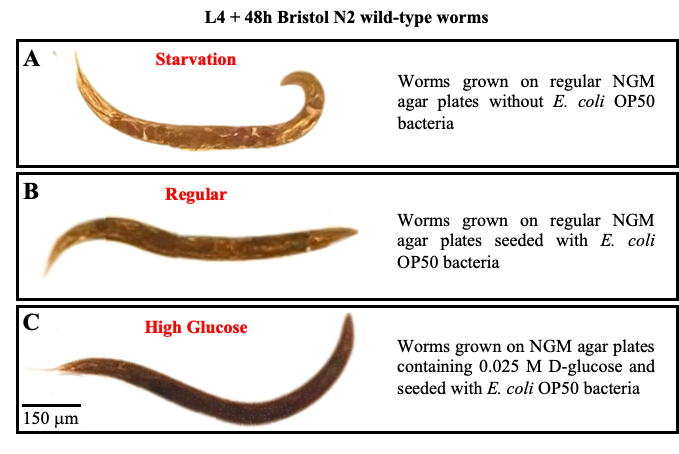Bristol N2 worms; starvation, regular, high glucose conditions; microscopy, growth comparison.