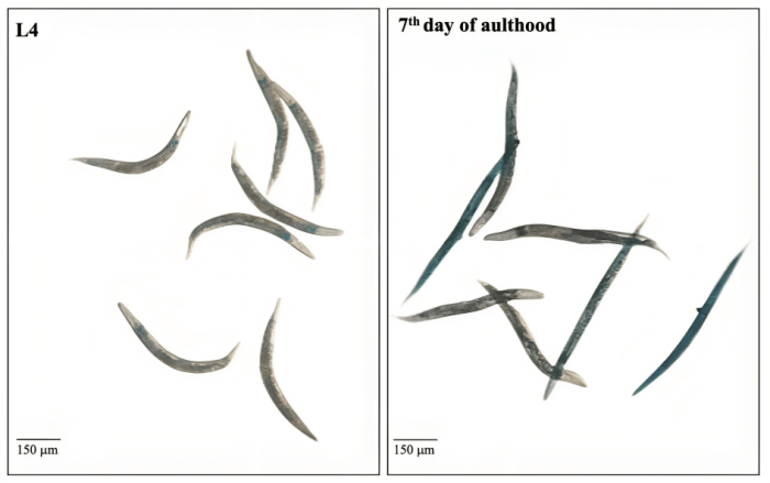 nematode development stages, microscope image, L4 larva, 7th-day adult, biological research