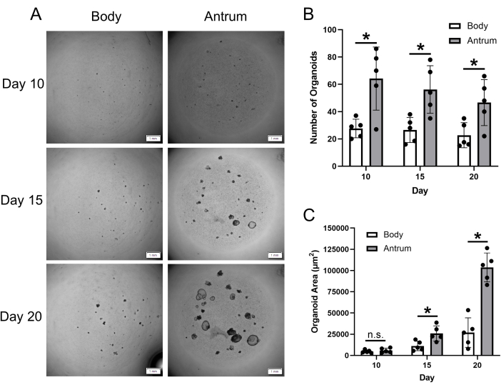 Organoid growth comparison; microscopy images, growth chart, statistical analysis; organoid area, count.