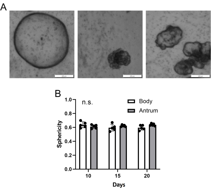 Gastric organoid development stages; sphericity analysis graph comparing body and antrum regions.