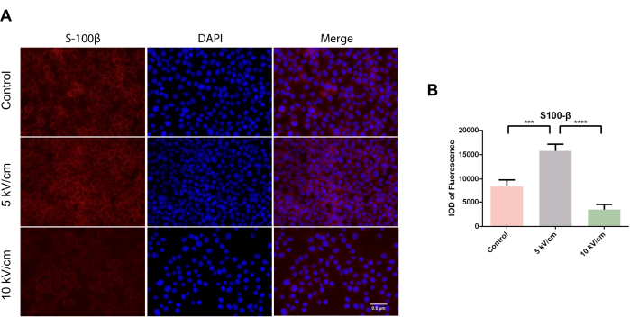 figure-results-2 Immunofluorescence microscopy of S-100β protein with DAPI staining and bar graph fluorescence results.